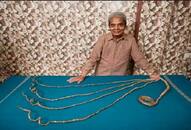 80-year-old Indian man grows nails for 66 years and finally decides to cut them