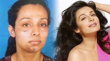 Stree actress Flora Saini shares her Me Too story on Facebook