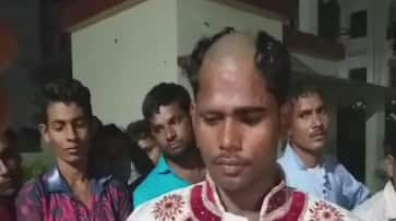 dowry Demand at the time of the marriage groom head shaved police lucknow