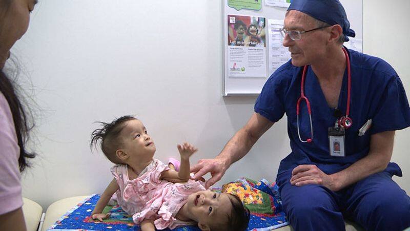 Conjoined twin babies... six-hour surgery