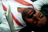 Telangana assembly election  Congress candidate Vamshichand Reddy attacked hospitalised video