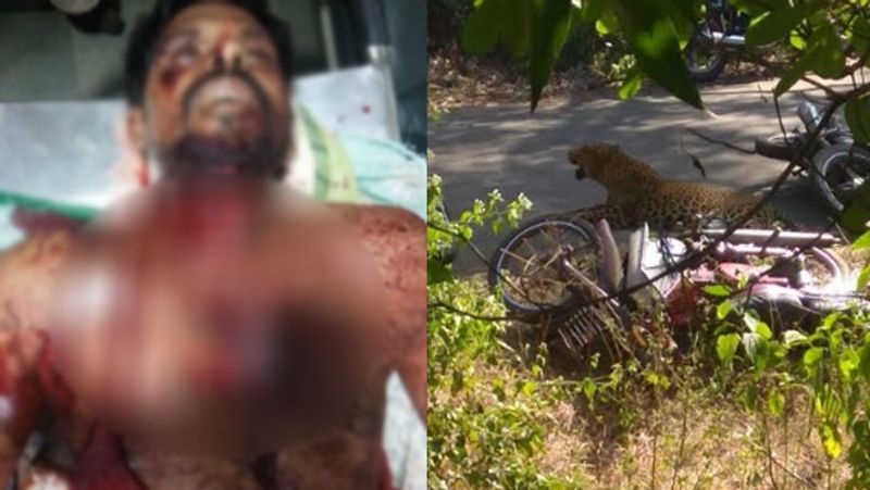 young man attacked by a leopard