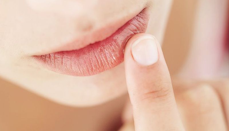 home remedies for chapped lips