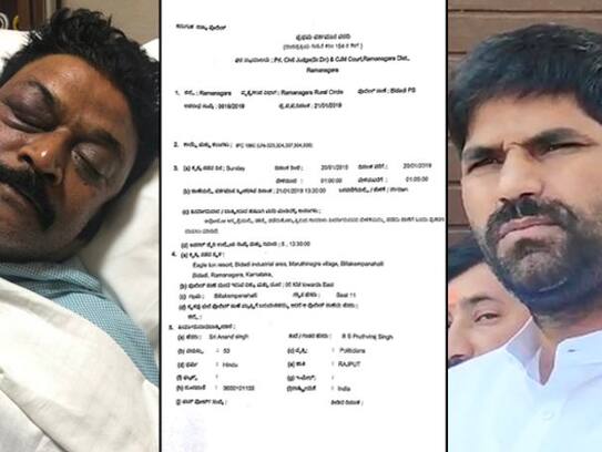 Karnataka: Congress MLA Anand Singh register FIR Against JN Ganesh