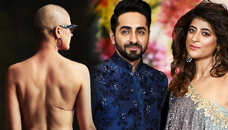 Ayushmann Khurrana's wife Tahira Kashyap shows off her scars in powerful pic on World Cancer Day. See pic