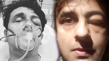 Sonu Nigam in ICU after food allergy