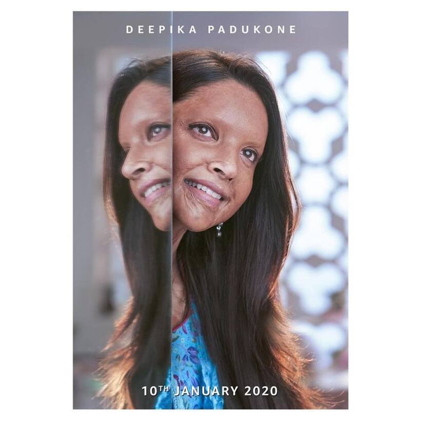 फिल्म ‘Chhapaak’ से दीपिका पादुकोण का पहला लुक जारी, एसिड अटैक सर्वाइवर पर है कहानी