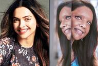 Chhapaak first look: Deepika Padukone as acid attack survivor Laxmi Agarwal is eerily convincing