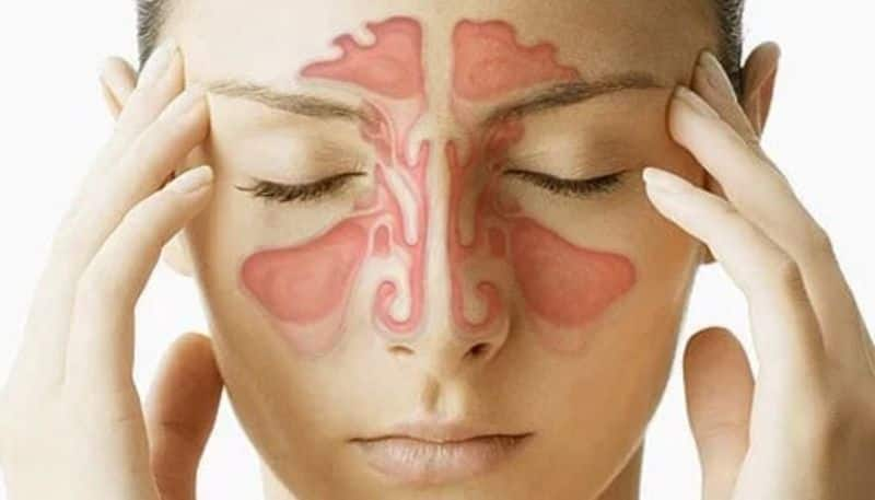 Suffering from sinus: Home remedies that can effectively bring relief naturally-dnm