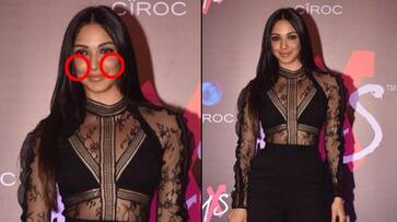 Kabir Singh actor Kiara Advani spills the beans on her swollen cheeks