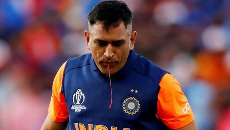 more news on dhoni's thump injury