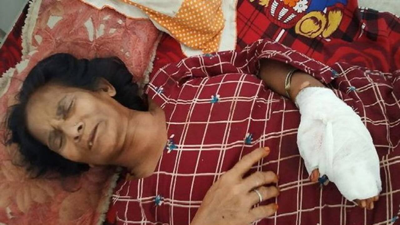 महिला को अकेला पाकर डोल गई भिखारियों की नीयत, लूटपाट के बाद इतना पीटा कि लगाने पड़े 100 टांके