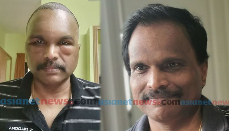 malayali doctor explains about misunderstanding happen to police after plastic surgery