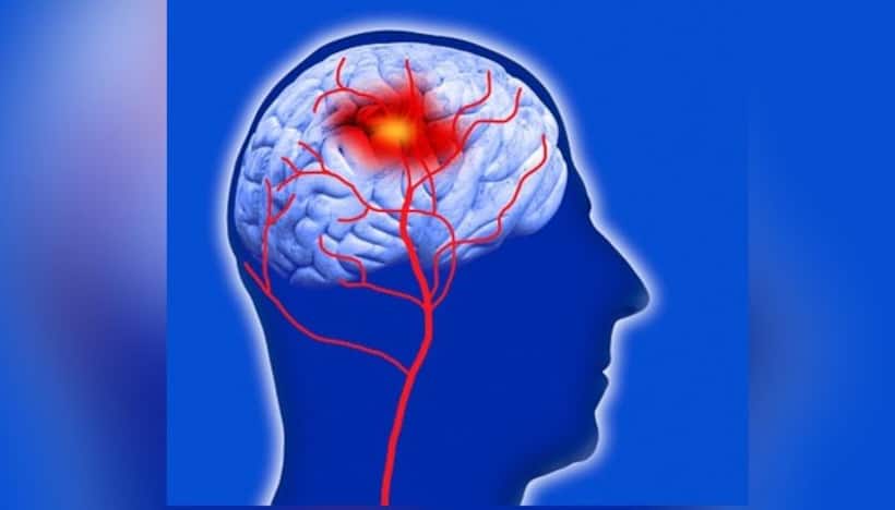 Did you know more screen time can push you closer to stroke risk? Here's what study reveals
