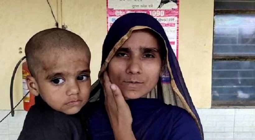 बाप ने तीन साल के मासूम की बेरहमी से की पिटाई, मां ने की पुलिस में शिकायत