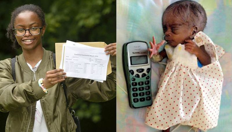 A girl who was born prematurely she was the size of a mobile phone