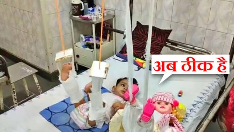 दर्द से कराह रही 11 महीने की बच्ची ने पकड़ी जिद पहले गुड़िया को प्लास्टर चढ़ाओ, बाद में हमें