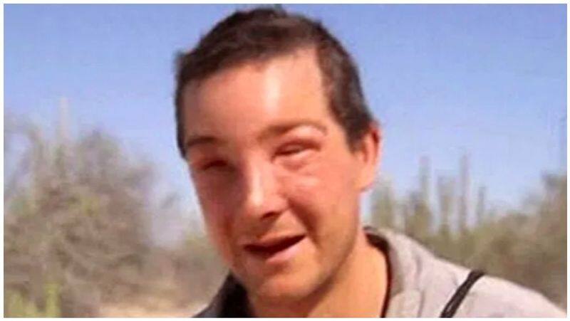 Bear Grylls saved by medics after bee sting knockout