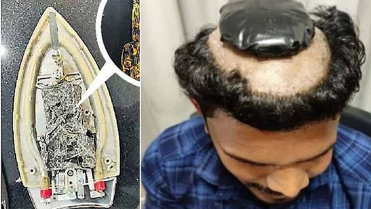 गोल्ड स्मलिंग के ये तरीके देखकर आप भी कहेंगे हे भगवान क्या क्या करते हैं  स्मगलर