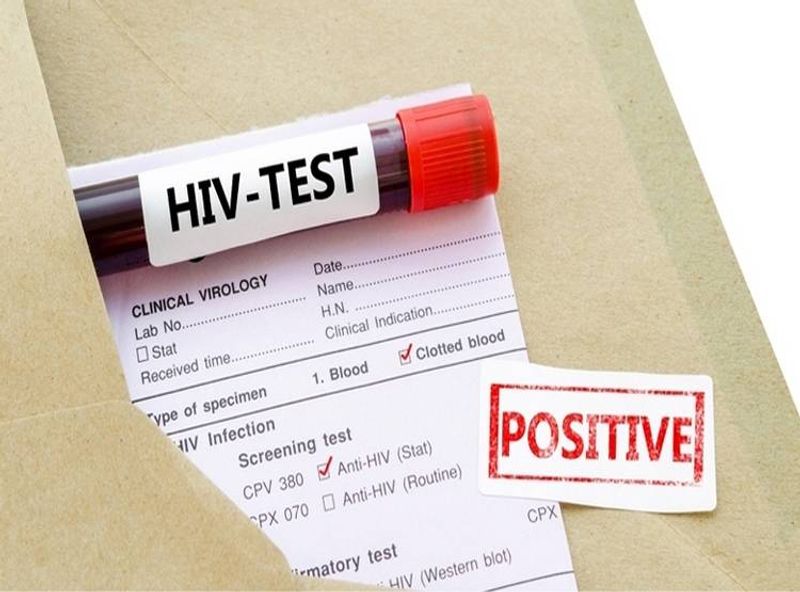 Tripura On Alert As HIV Infection On Rise In State 47 Students Dead 828 Found Positive skr