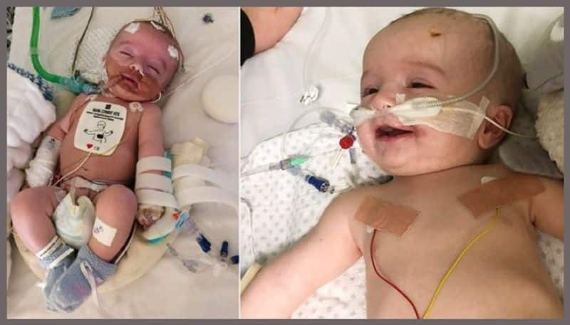 Baby boy defies doctors by waking from 5-day coma and smiling at dad