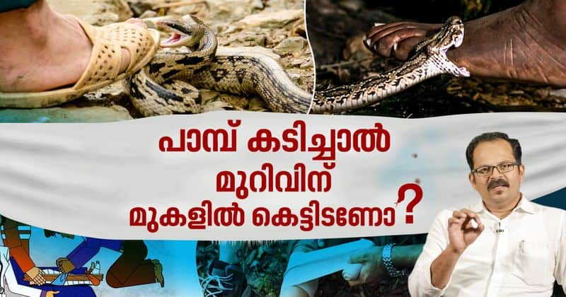 what is the first aid treatment for snake bite