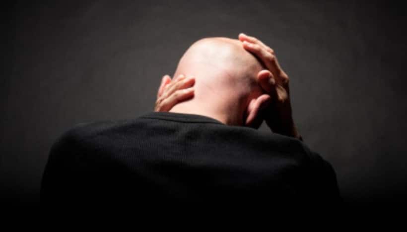 Baldness