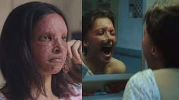 Chhapaak Trailer: Deepika Padukone gives goosebumps with her act as acid attack survivor Laxmi Agarwal