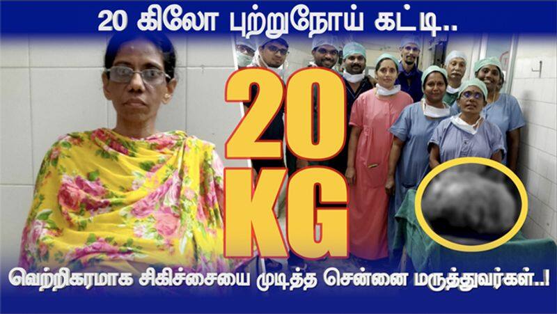 Woman Carried 20 KG Cancer Cyst Chennai Doctors Successfully Finished Operation video