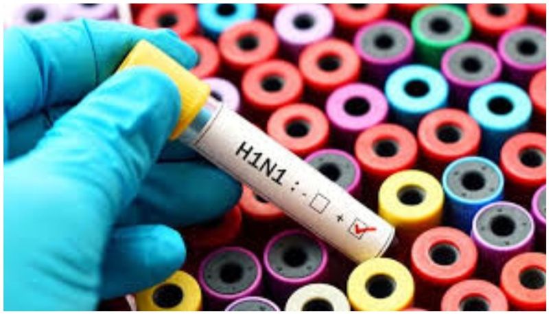 Causes and symptoms of h1n1 flu