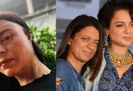 Chhapaak in Kangana Ranaut's sister's life; Rangoli shares acid attacker's name and more