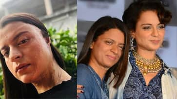 Chhapaak in Kangana Ranaut's sister's life; Rangoli shares acid attacker's name and more