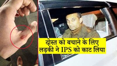 JNU प्रदर्शन के दौरान लड़की ने IPS के हाथ पर काटा, Photos में देखिए कैसे गए अस्पताल