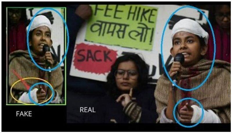 ishe ghoshe injured her left hand and the viral photo is fake fact check