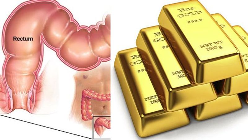 men smuggling gold inrectum was arrested in mangalore