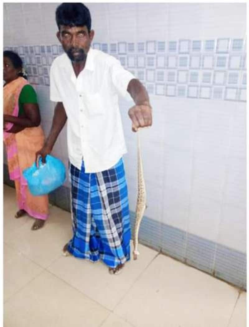 man came with snake to hospital which bitten him