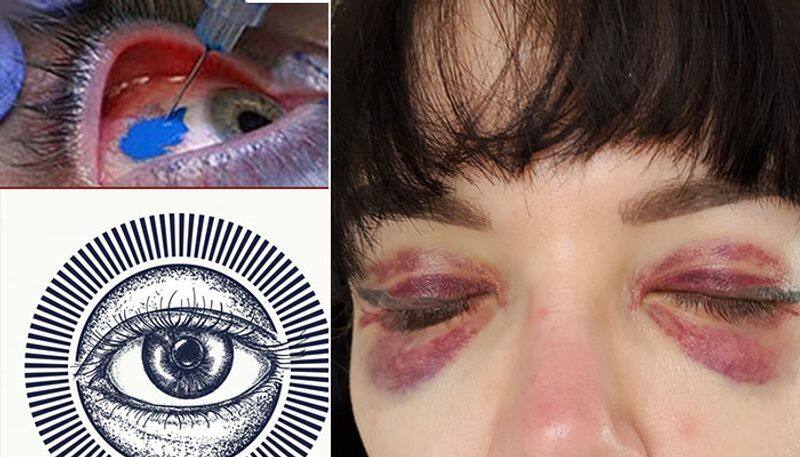 Girl tattoos eyeballs; goes blind trying to copy rapper