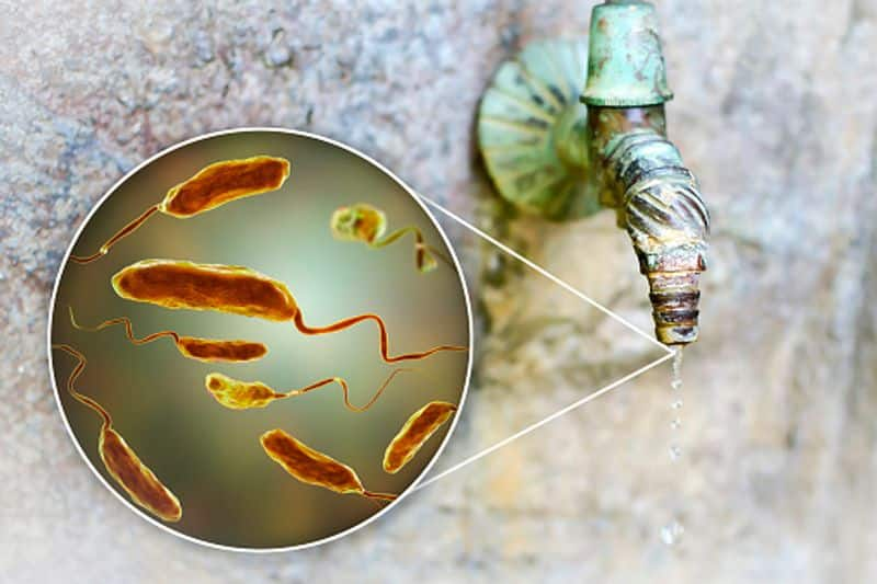 Cholera Suspected in the Young Woman in Bengaluru grg 