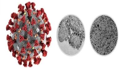 जिस वायरस ने दुनिया की नाक में कर रखा है दम; जानिए कैसा दिखता है कोरोना वायरस , सामने आई यह तस्वीर