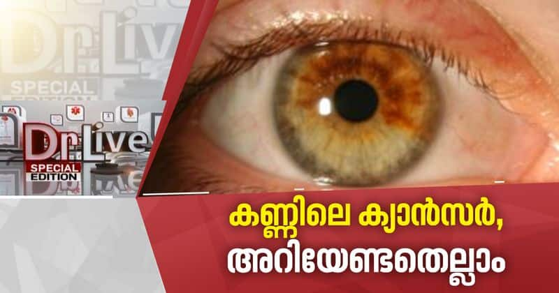 Eye Cancer Doctor Live Treatment and causes