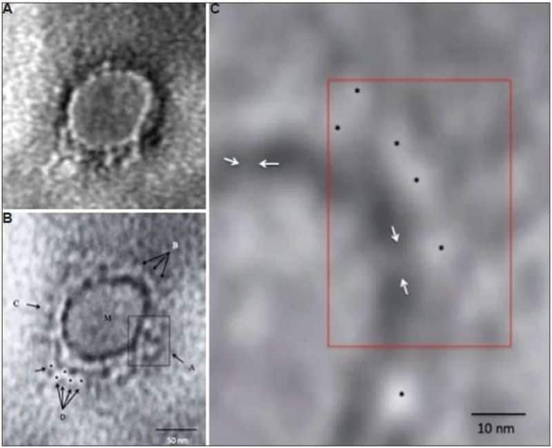 First Images Of Coronavirus Released from India