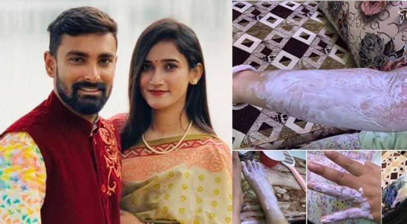 క్రికెటర్ ఇంట్లో పేలిన సిలిండర్...భార్యకు గాయాలు