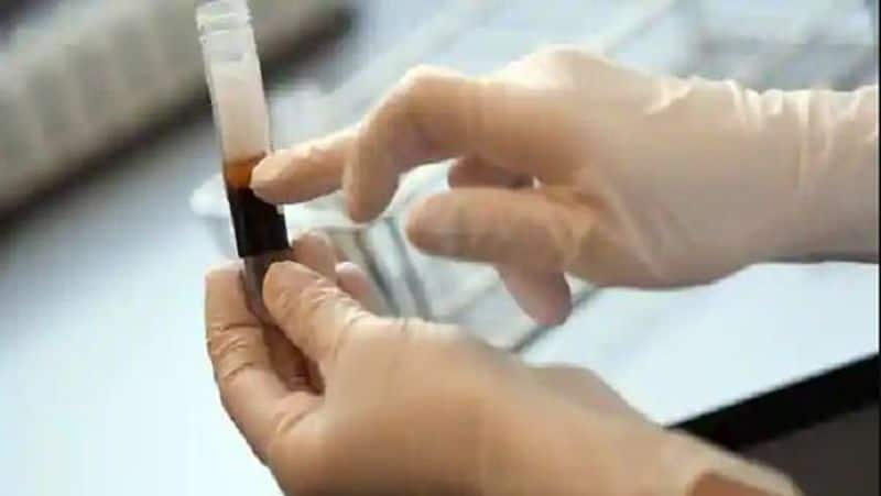 Police Seize Smartphones Coronavirus victims Family in Vijayapura