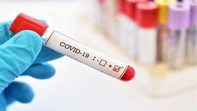 Coronavirus Trump administration sending rapid COVID-19 tests to states, CDC bars evictions-dnm