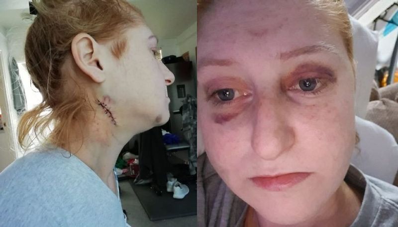 woman shares her terrific experience of domestic violence