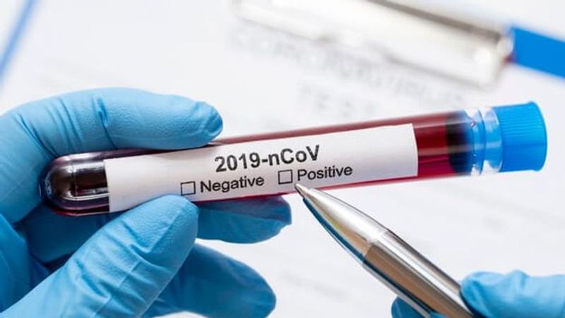 2709 New Coronavirus cases reported in India 93 death