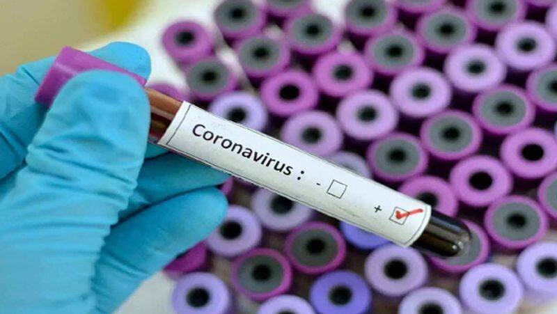 Males More Susceptible To Coronavirus Than Females, Researchers Explain The Reason