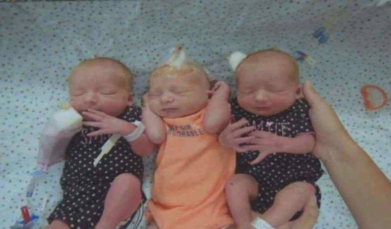 Corona virus infection in triplets  born at the same time ... Doctors in shock