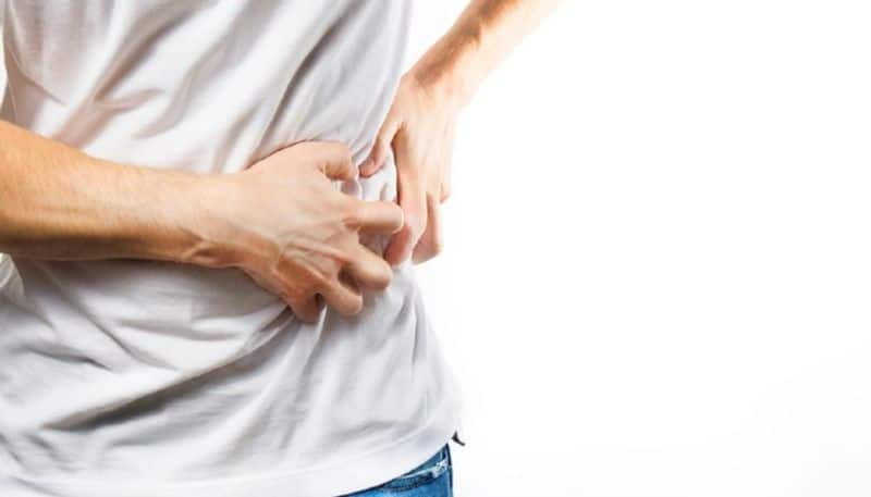 kidney stone symptoms and causes