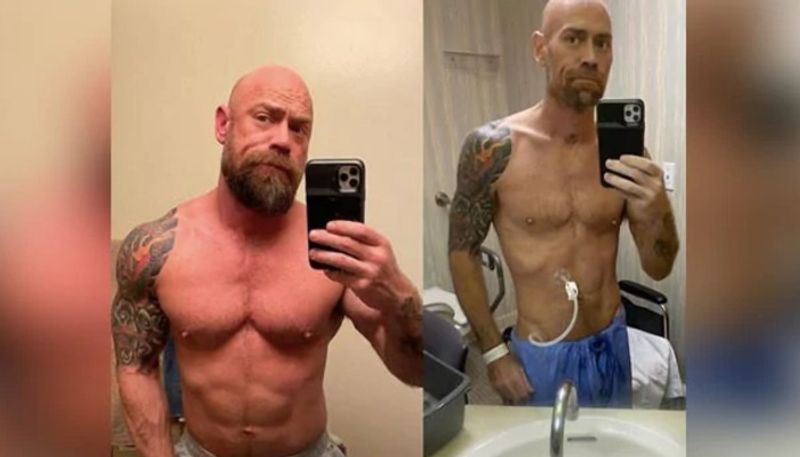 covid 19 survivor shares images of his body transformation due to disease